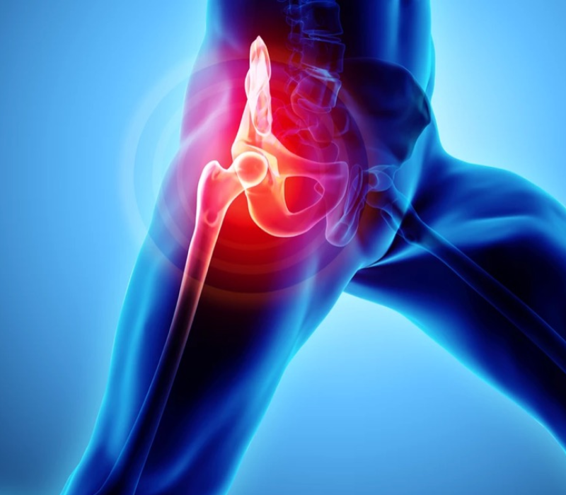 Substituição_(Foto)